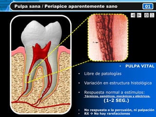 Pulpa sana / Periapice aparentemente sano 01
• PULPA VITAL
• Libre de patologías
• Variación en estructura histológica
• Respuesta normal a estímulos:
Térmicos, osmóticos, mecánicos y eléctricos.
(1-2 SEG.)
• No respuesta a la percusión, ni palpación
• RX  No hay rarefacciones
 