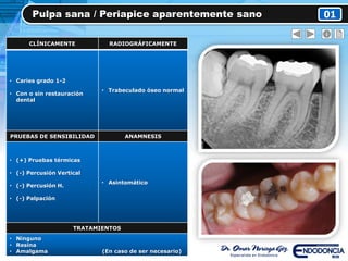 Pulpa sana / Periapice aparentemente sano 01
CLÍNICAMENTE RADIOGRÁFICAMENTE
• Caries grado 1-2
• Con o sin restauración
dental
• Trabeculado óseo normal
PRUEBAS DE SENSIBILIDAD ANAMNESIS
• (+) Pruebas térmicas
• (-) Percusión Vertical
• (-) Percusión H.
• (-) Palpación
• Asintomático
TRATAMIENTOS
• Ninguno
• Resina
• Amalgama (En caso de ser necesario)
 