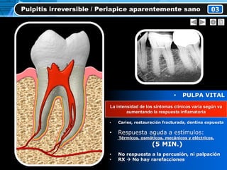 Pulpitis irreversible / Periapice aparentemente sano 03
• PULPA VITAL
• Inflamación irreversible
del tej. Pulpar (PROGRESIVA )
• Caries, restauración fracturada, dentina expuesta
• Respuesta aguda a estímulos:
Térmicos, osmóticos, mecánicos y eléctricos.
(5 MIN.)
• No respuesta a la percusión, ni palpación
• RX  No hay rarefacciones
Incremento en la presión tisular
La intensidad de los síntomas clínicos varía según va
aumentando la respuesta inflamatoria
 
