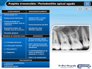 Pulpitis irreversible / Periodontitis apical aguda 04
CLÍNICAMENTE RADIOGRÁFICAMENTE
• Caries grado 2-3
• Restauración deficiente
• Fractura dental con
exposición pulpar (días de
evolución)
• Exposición pulpar por
fresado (días de evolución)
• Recesión gingival
• Restauración o caries
próxima a la pulpa
• Ensanchamiento del ELP
• Rarefacción ósea
INICIAL (Apical)
PRUEBAS DE SENSIBILIDAD ANAMNESIS
• (+) Pruebas térmicas
• (+) Percusión Vertical
• (-) Percusión H.
• (-) Palpación
• Sintomatología Aguda
(El dolor no lo dejo dormir)
• Dolor dental provocado
por estímulos térmicos y
osmóticos
• La sintomatología no se
retira al eliminar el
estimulo (+ 5 min.)
• Dolor a la masticación
TRATAMIENTOS
• Tratamiento endodóntico
• Pulpotomía
• Extracción dental
 