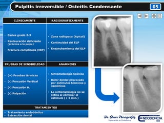 Pulpitis irreversible / Osteítis Condensante 05
CLÍNICAMENTE RADIOGRÁFICAMENTE
• Caries grado 2-3
• Restauración deficiente
(próxima a la pulpa)
• Fractura complicada (EDP)
• Zona radiopaca (Apical)
• Continuidad del ELP
• Ensanchamiento del ELP
PRUEBAS DE SENSIBILIDAD ANAMNESIS
• (+) Pruebas térmicas
• (-) Percusión Vertical
• (-) Percusión H.
• (-) Palpación
• Sintomatología Crónica
• Dolor dental provocado
por estímulos térmicos y
osmóticos
• La sintomatología no se
retira al eliminar el
estimulo (+ 5 min.)
TRATAMIENTOS
• Tratamiento endodóntico
• Extracción dental
 