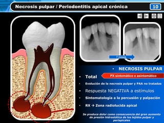 • NECROSIS PULPAR
• Total
• Evolución de la necrosis pulpar y PAA no tratadas
• Respuesta NEGATIVA a estímulos
• Sintomatología a la percusión y palpación
• RX  Zona radiolucida apical
Se produce dolor como consecuencia del gran aumento
de presión hidrostática de los tejidos pulpar y
periapicales
Necrosis pulpar / Periodontitis apical crónica 10
PX sintomático o asintomático
7 meses
 
