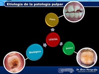 Etiología de la patología pulpar
 