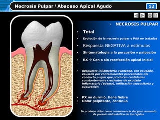 • NECROSIS PULPAR
• Total
• Evolución de la necrosis pulpar y PAA no tratadas
• Respuesta NEGATIVA a estímulos
• Sintomatología a la percusión y palpación
• RX  Con o sin rarefacción apical inicial
• Respuesta inflamatoria avanzada, con exudado,
causada por contaminantes procedentes del
conducto pulpar que producen cantidades
constantemente crecientes de exudado
inflamatorio (edema), infiltración leucocitaria y
supuración.
• PX no durmió, tiene fiebre
• Dolor palpitante, continuo
Se produce dolor como consecuencia del gran aumento
de presión hidrostática de los tejidos
Necrosis Pulpar / Absceso Apical Agudo 12
 
