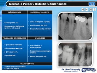 Necrosis Pulpar / Osteítis Condensante 13
CLÍNICAMENTE RADIOGRÁFICAMENTE
• Caries grado 2-3
• Restauración deficiente
(próxima a la pulpa)
• Zona radiopaca (Apical)
• Continuidad del ELP
• Ensanchamiento del ELP
PRUEBAS DE SENSIBILIDAD ANAMNESIS
• (-) Pruebas térmicas
• (-) Percusión Vertical
• (-) Percusión H.
• (-) Palpación
• Sintomático o
Asintomático
• Presentó sintomatología
crónica
• Meses de evolución
TRATAMIENTOS
• Tratamiento endodóntico
• Extracción dental
 