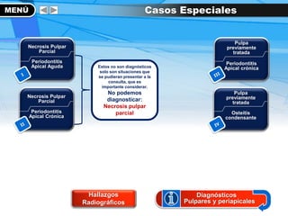 MENÚ
Hallazgos
Radiográficos
Casos Especiales
Diagnósticos
Pulpares y periapicales
Pulpa
previamente
tratada
Periodontitis
Apical crónica
Pulpa
previamente
tratada
Osteítis
condensante
Estos no son diagnósticos
solo son situaciones que
se pudieran presentar a la
consulta, que es
importante considerar.
No podemos
diagnosticar:
Necrosis pulpar
parcial
Necrosis Pulpar
Parcial
Periodontitis
Apical Aguda
Necrosis Pulpar
Parcial
Periodontitis
Apical Crónica
 