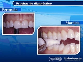 Pruebas de diagnóstico
Percusión
Mordida
 