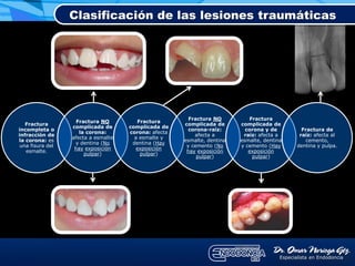 Fractura
incompleta o
infracción de
la corona: es
una fisura del
esmalte.
Fractura NO
complicada de
la corona:
afecta a esmalte
y dentina (No
hay exposición
pulpar)
Fractura
complicada de
corona: afecta
a esmalte y
dentina (Hay
exposición
pulpar)
Fractura NO
complicada de
corona-raíz:
afecta a
esmalte, dentina
y cemento (No
hay exposición
pulpar)
Fractura
complicada de
corona y de
raíz: afecta a
esmalte, dentina
y cemento (Hay
exposición
pulpar)
Fractura de
raíz: afecta al
cemento,
dentina y pulpa.
Clasificación de las lesiones traumáticas
 