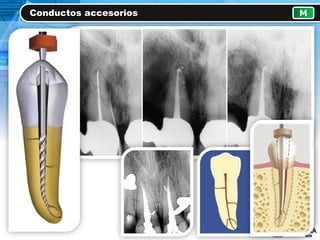 Conductos accesorios M
 
