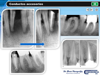 Conductos accesorios M
 