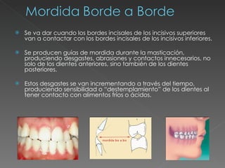 Se va dar cuando los bordes incisales de los incisivos superiores van a contactar con los bordes incisales de los incisivos inferiores. Se producen guías de mordida durante la masticación, produciendo desgastes, abrasiones y contactos innecesarios, no solo de los dientes anteriores, sino también de los dientes posteriores. Estos desgastes se van incrementando a través del tiempo, produciendo sensibilidad o “destemplamiento” de los dientes al tener contacto con alimentos fríos o ácidos.  