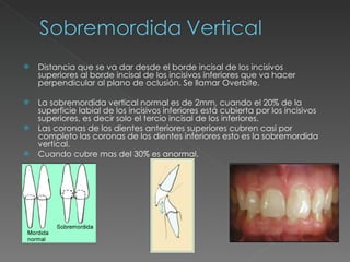Distancia que se va dar desde el borde incisal de los incisivos superiores al borde incisal de los incisivos inferiores que va hacer perpendicular al plano de oclusión. Se llamar Overbite. La sobremordida vertical normal es de 2mm, cuando el 20% de la superficie labial de los incisivos inferiores está cubierta por los incisivos superiores, es decir solo el tercio incisal de los inferiores. Las coronas de los dientes anteriores superiores cubren casi por completo las coronas de los dientes inferiores esto es la sobremordida vertical. Cuando cubre mas del 30% es anormal. 