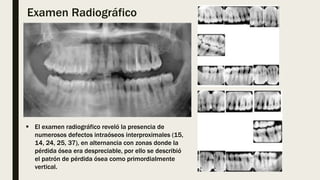 Examen Radiográfico
 El examen radiográfico reveló la presencia de
numerosos defectos intraóseos interproximales (15,
14, 24, 25, 37), en alternancia con zonas donde la
pérdida ósea era despreciable, por ello se describió
el patrón de pérdida ósea como primordialmente
vertical.
 