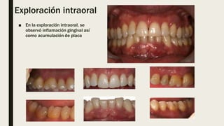 Exploración intraoral
■ En la exploración intraoral, se
observó inflamación gingival así
como acumulación de placa
 