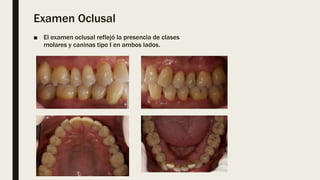 Examen Oclusal
■ El examen oclusal reflejó la presencia de clases
molares y caninas tipo I en ambos lados.
 