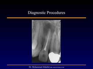 Diagnostic Procedures




Dr. Mohammed Alshehri BDS, AEGD, SSC-Resto, SF-DI
 