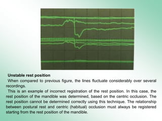 orthodontic Diagnostic procedures 2 | PPT