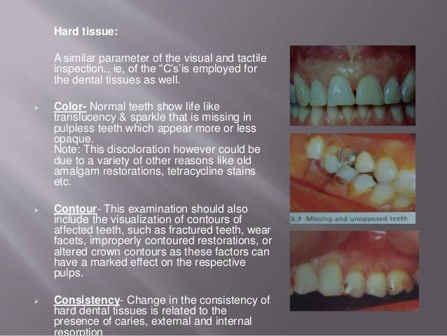 pressure test procedure endodontics procedures in Diagnostic