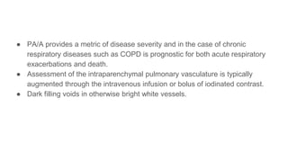 Pa Using Respiration Diagnostic procedures in Respiratory Disease.pptx