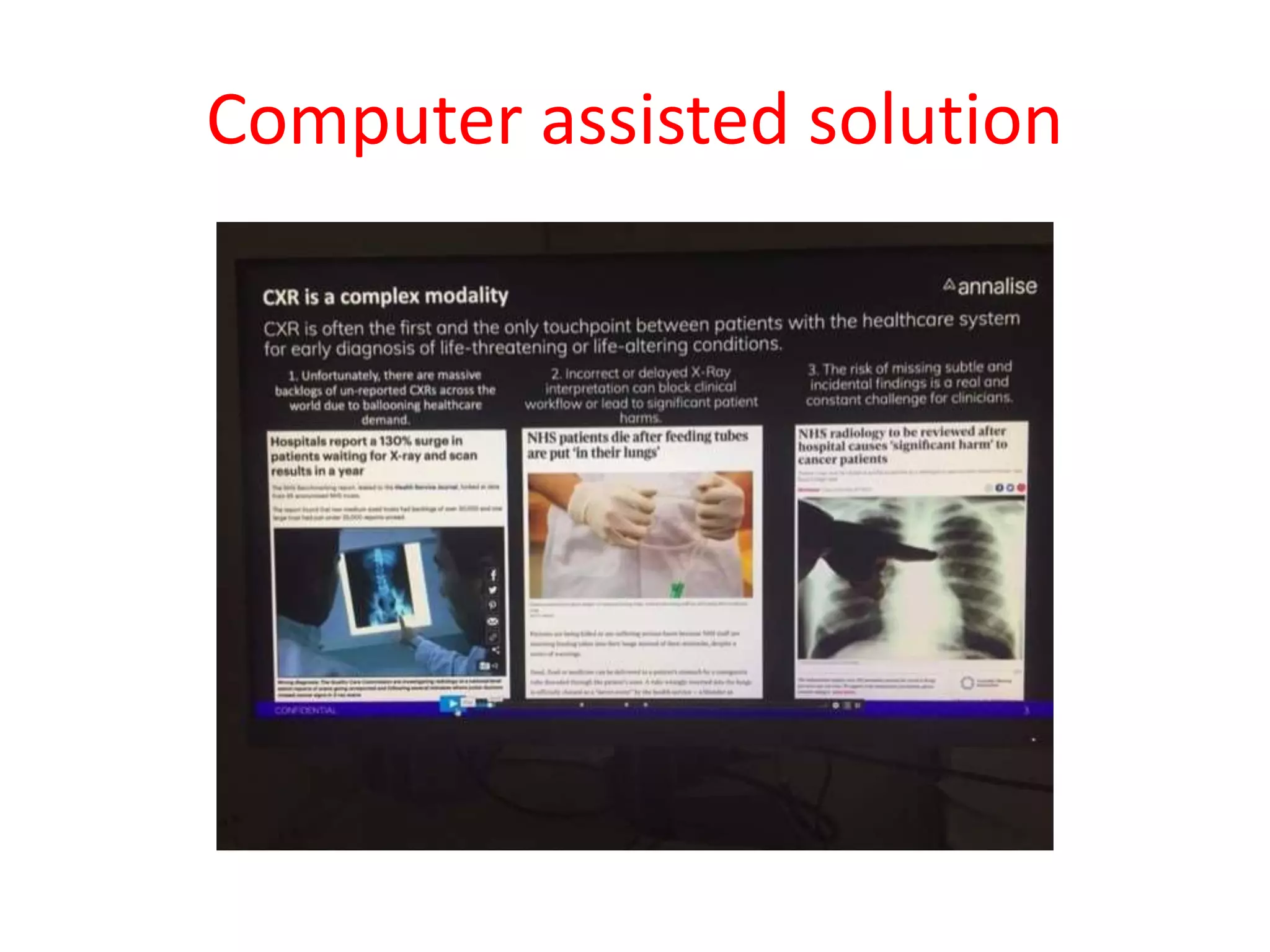 Computer assisted solution
 