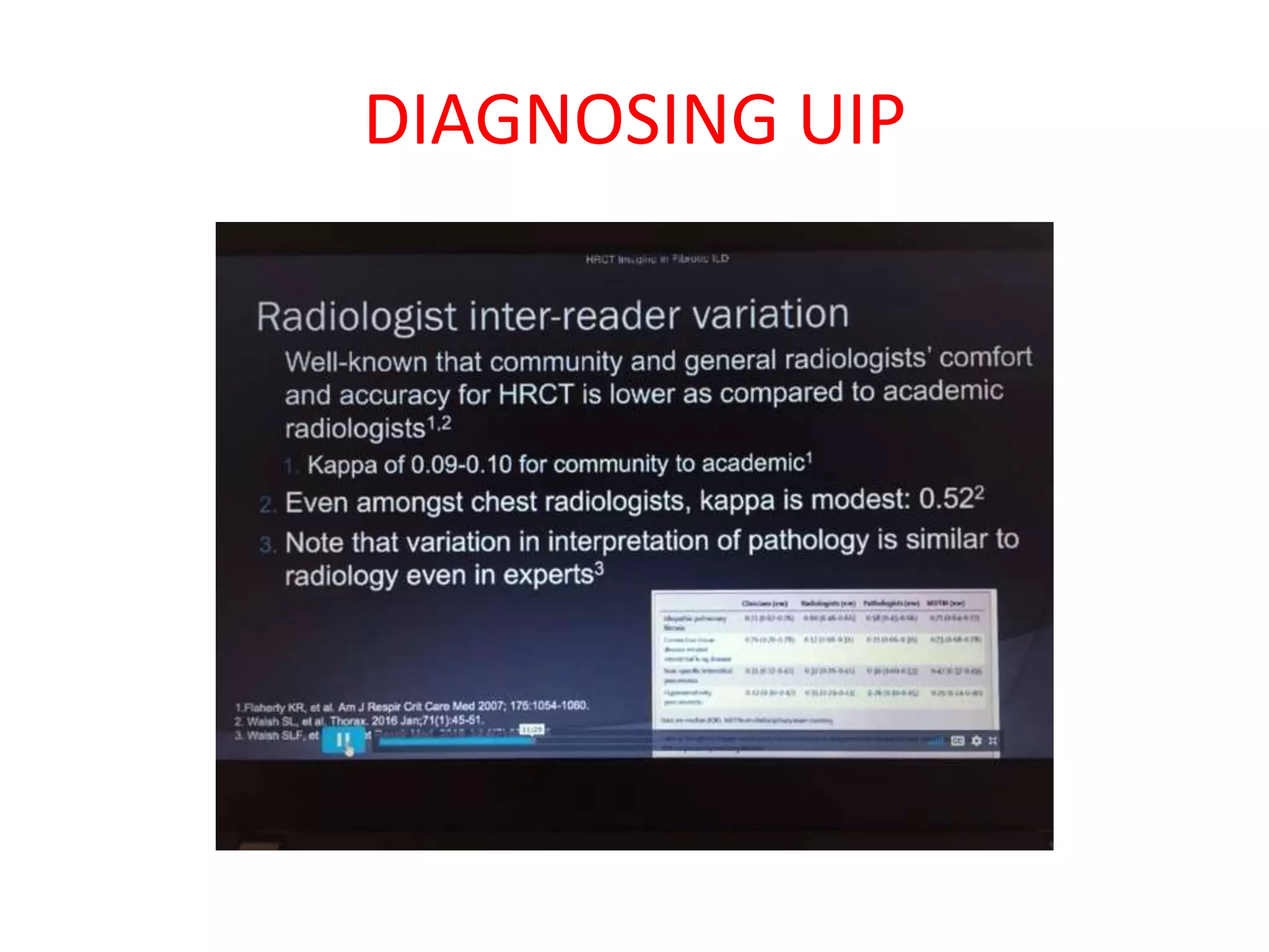 DIAGNOSING UIP
 