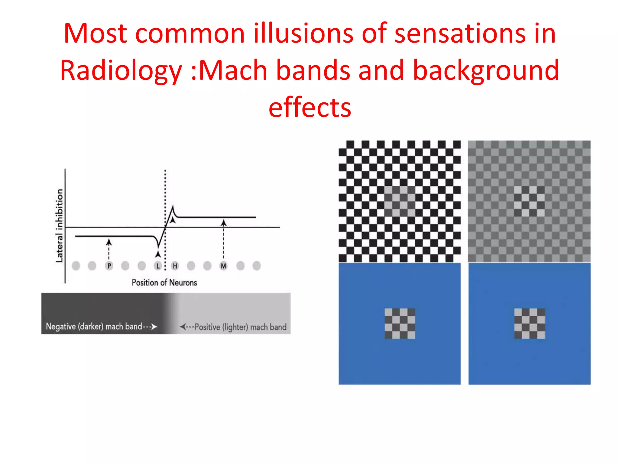 Most common illusions of sensations in
Radiology :Mach bands and background
effects
 