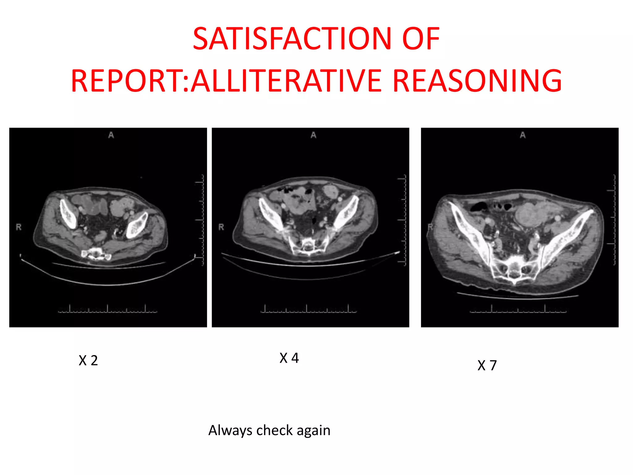 SATISFACTION OF
REPORT:ALLITERATIVE REASONING
X 2 X 4 X 7
Always check again
 