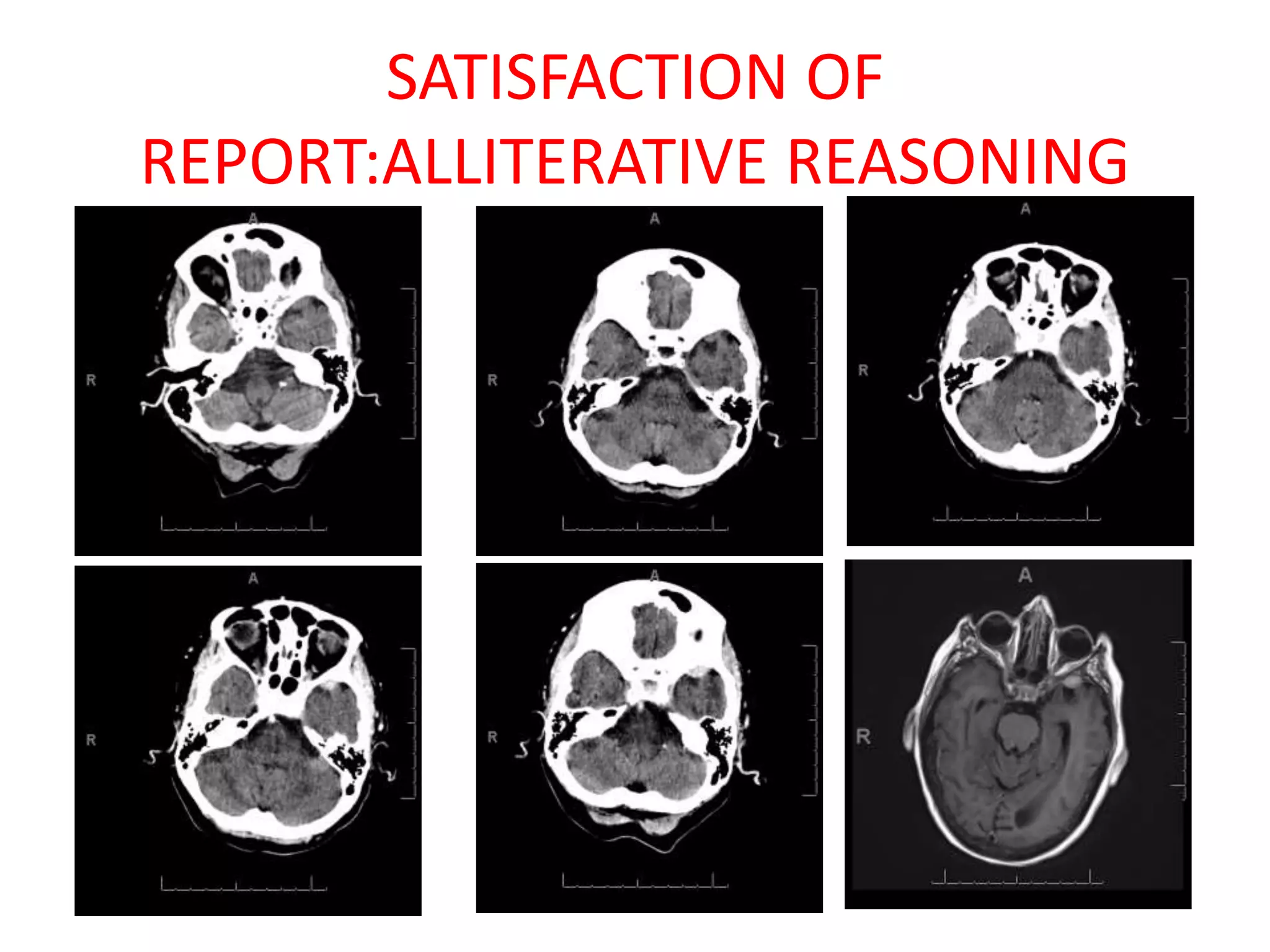 SATISFACTION OF
REPORT:ALLITERATIVE REASONING
 