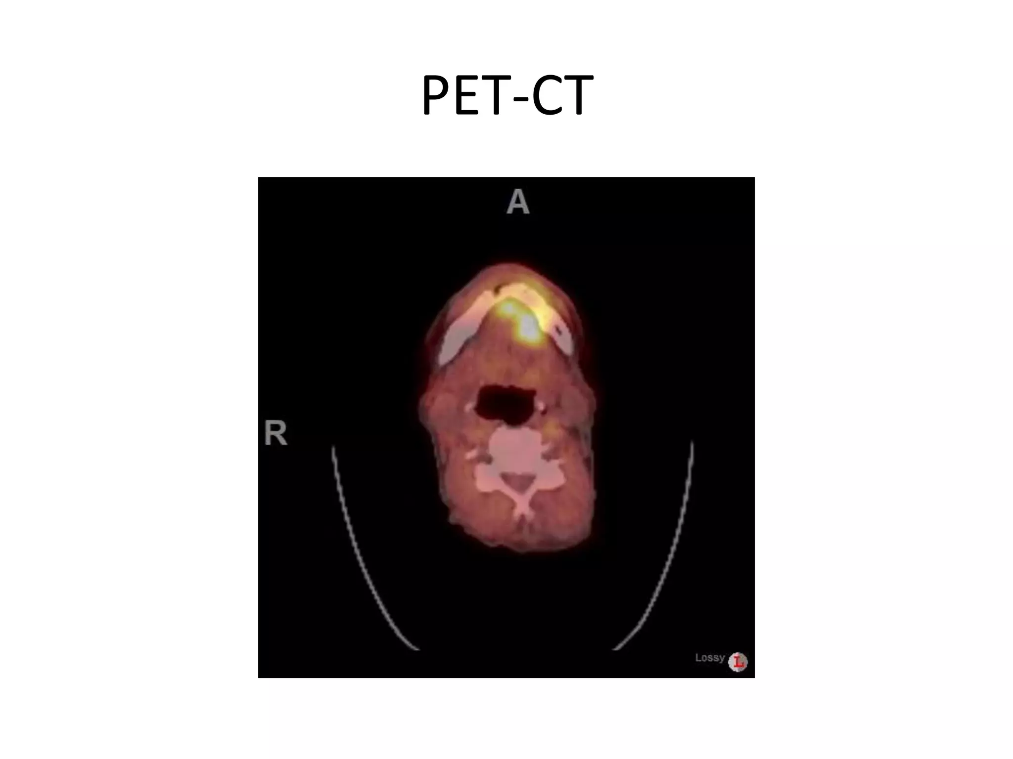 PET-CT
 