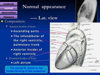 Normal  appearance  ----   Lat. view <ul><li>Composition: </li></ul><ul><ul><li>Anterior border of heart   </li></ul></ul>...