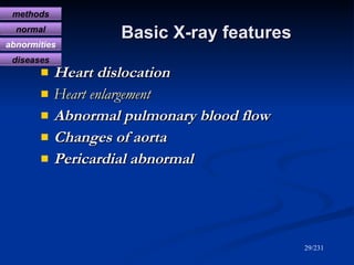 Basic X-ray features <ul><li>Heart dislocation </li></ul><ul><li>Heart enlargement </li></ul><ul><li>Abnormal pulmonary bl...
