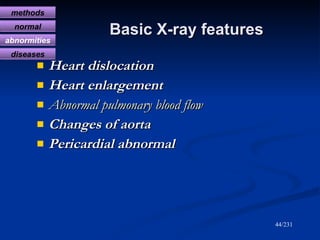 Basic X-ray features <ul><li>Heart dislocation </li></ul><ul><li>Heart enlargement </li></ul><ul><li>Abnormal pulmonary bl...