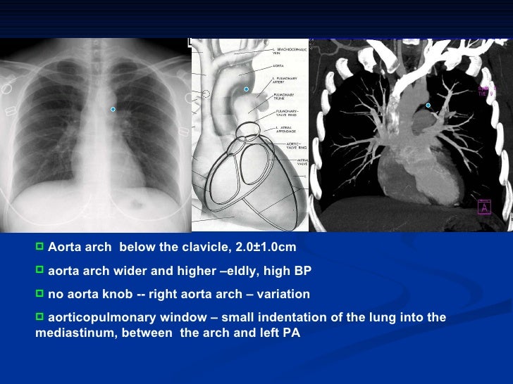 Diagnostic radiology of cardiovascular 2009