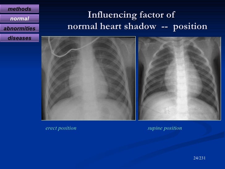Diagnostic radiology of cardiovascular 2009