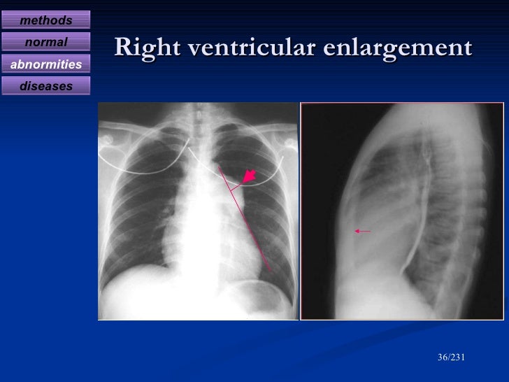 Diagnostic radiology of cardiovascular 2009