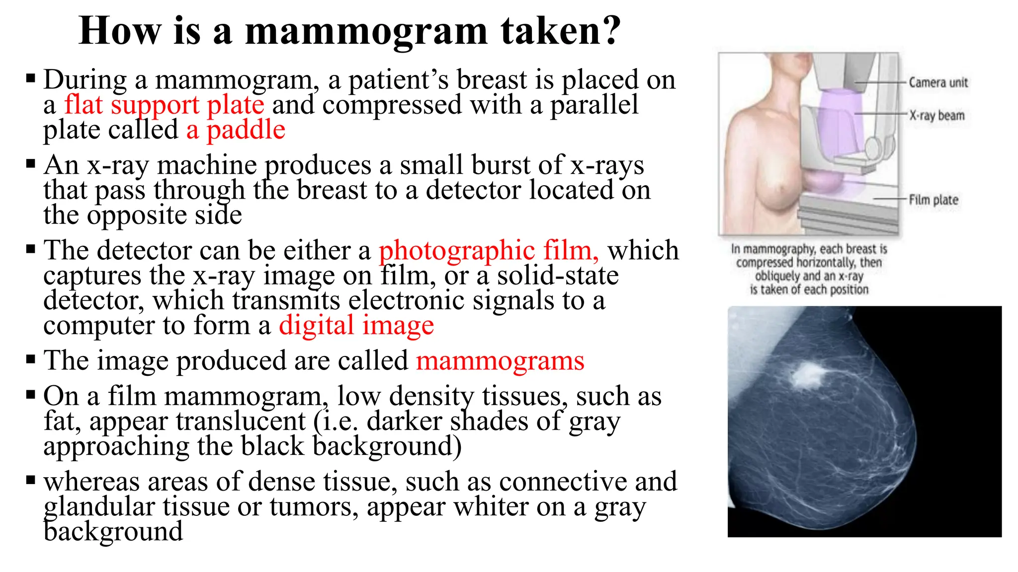 How is a mammogram taken?
▪ During a mammogram, a patient’s breast is placed on
a flat support plate and compressed with a parallel
plate called a paddle
▪ An x-ray machine produces a small burst of x-rays
that pass through the breast to a detector located on
the opposite side
▪ The detector can be either a photographic film, which
captures the x-ray image on film, or a solid-state
detector, which transmits electronic signals to a
computer to form a digital image
▪ The image produced are called mammograms
▪ On a film mammogram, low density tissues, such as
fat, appear translucent (i.e. darker shades of gray
approaching the black background)
▪ whereas areas of dense tissue, such as connective and
glandular tissue or tumors, appear whiter on a gray
background
 