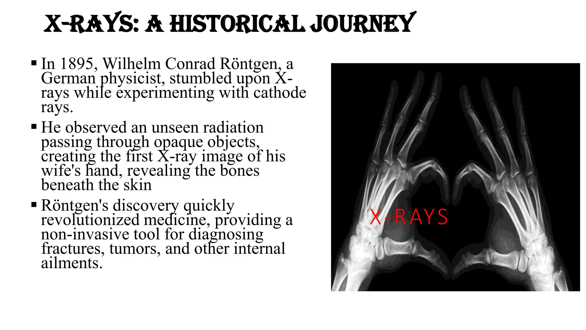 X-rays: A Historical Journey
▪ In 1895, Wilhelm Conrad Röntgen, a
German physicist, stumbled upon X-
rays while experimenting with cathode
rays.
▪ He observed an unseen radiation
passing through opaque objects,
creating the first X-ray image of his
wife's hand, revealing the bones
beneath the skin
▪ Röntgen's discovery quickly
revolutionized medicine, providing a
non-invasive tool for diagnosing
fractures, tumors, and other internal
ailments.
X-RAYS
 