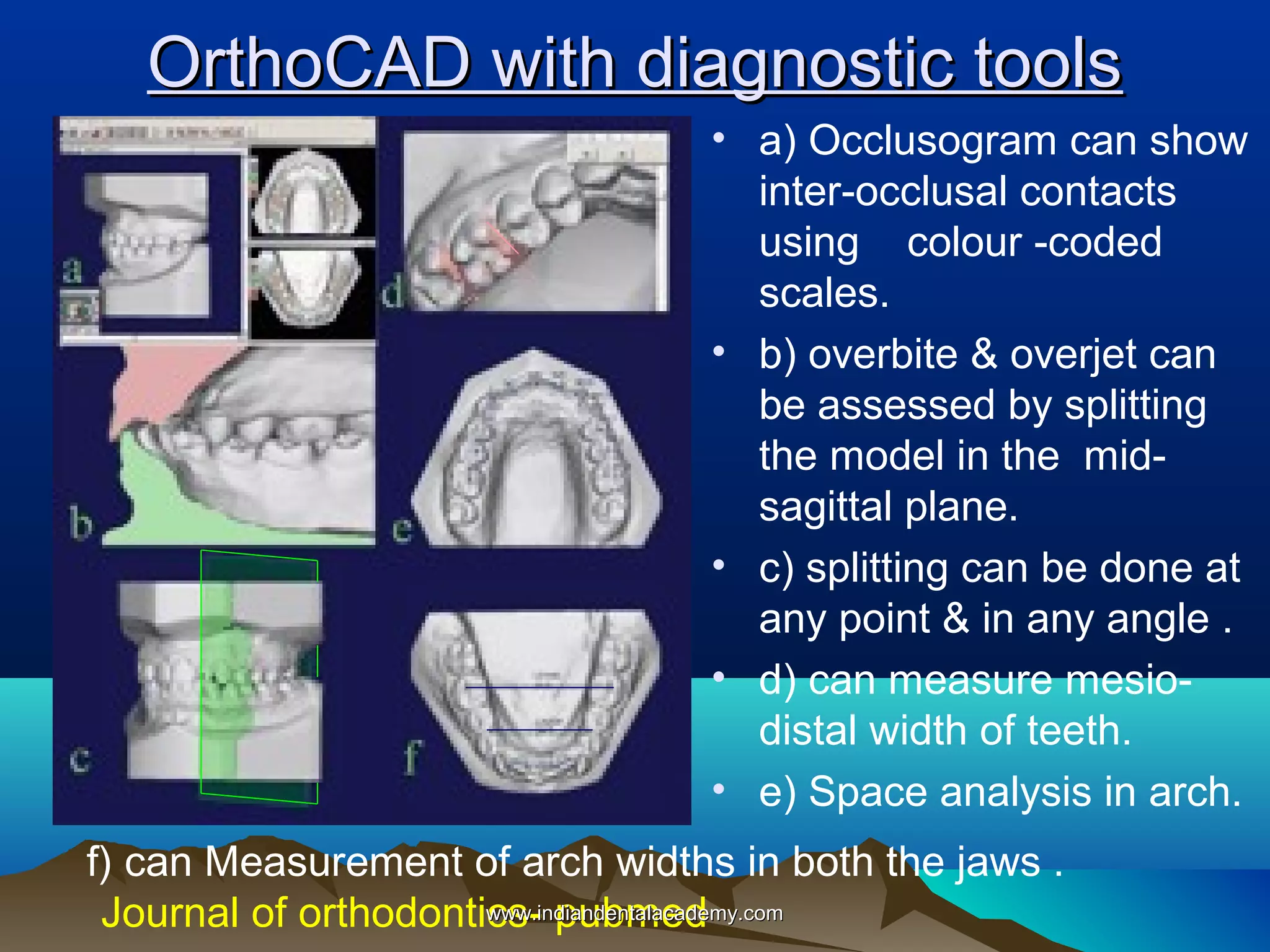 OrthoCAD with diagnostic tools
• a) Occlusogram can show
inter-occlusal contacts
using colour -coded
scales.
• b) overbite & overjet can
be assessed by splitting
the model in the midsagittal plane.
• c) splitting can be done at
any point & in any angle .
• d) can measure mesiodistal width of teeth.
• e) Space analysis in arch.
f) can Measurement of arch widths in both the jaws .
www.indiandentalacademy.com
Journal of orthodontics- pubmed

 
