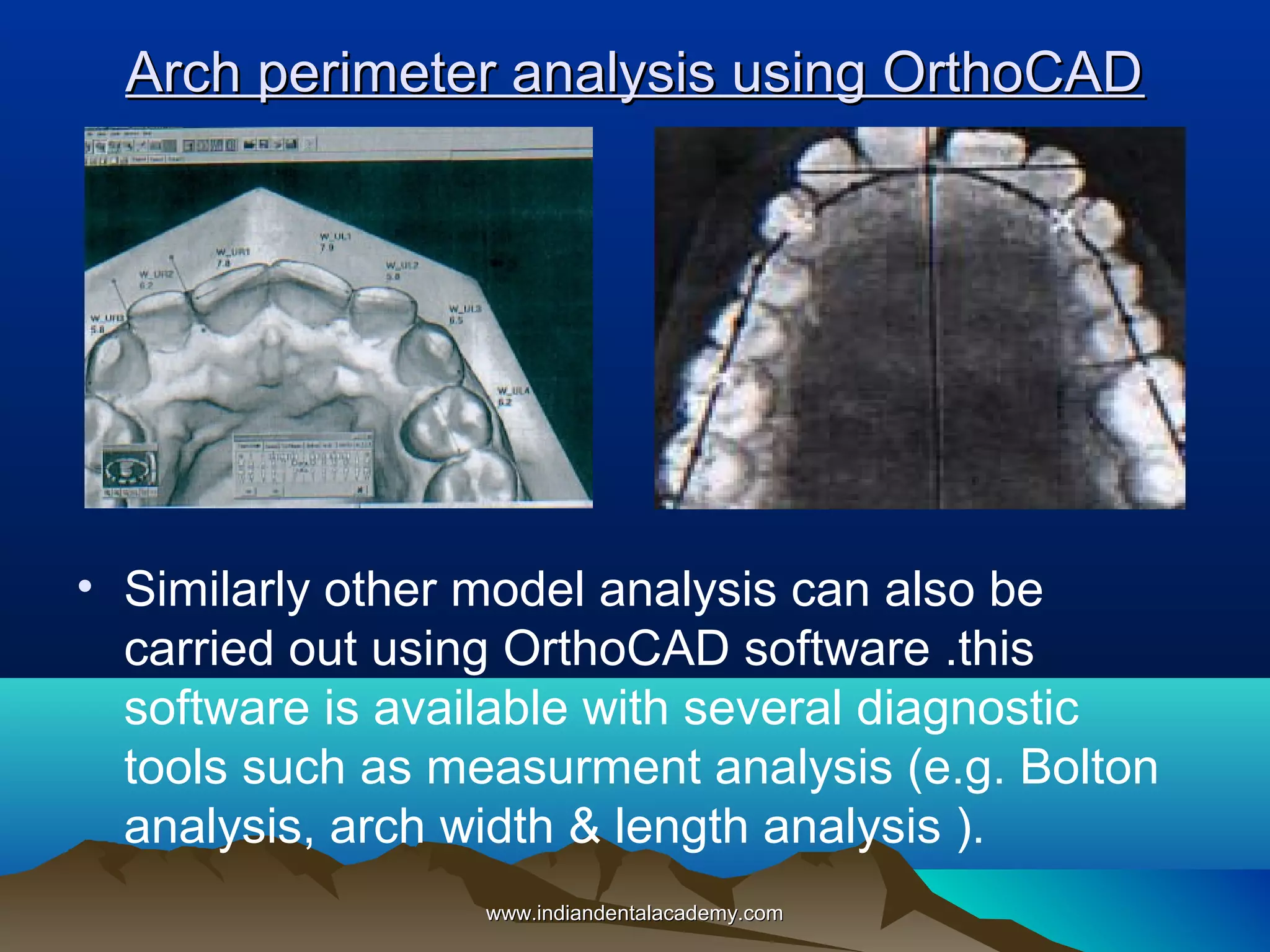Arch perimeter analysis using OrthoCAD

• Similarly other model analysis can also be
carried out using OrthoCAD software .this
software is available with several diagnostic
tools such as measurment analysis (e.g. Bolton
analysis, arch width & length analysis ).
www.indiandentalacademy.com

 