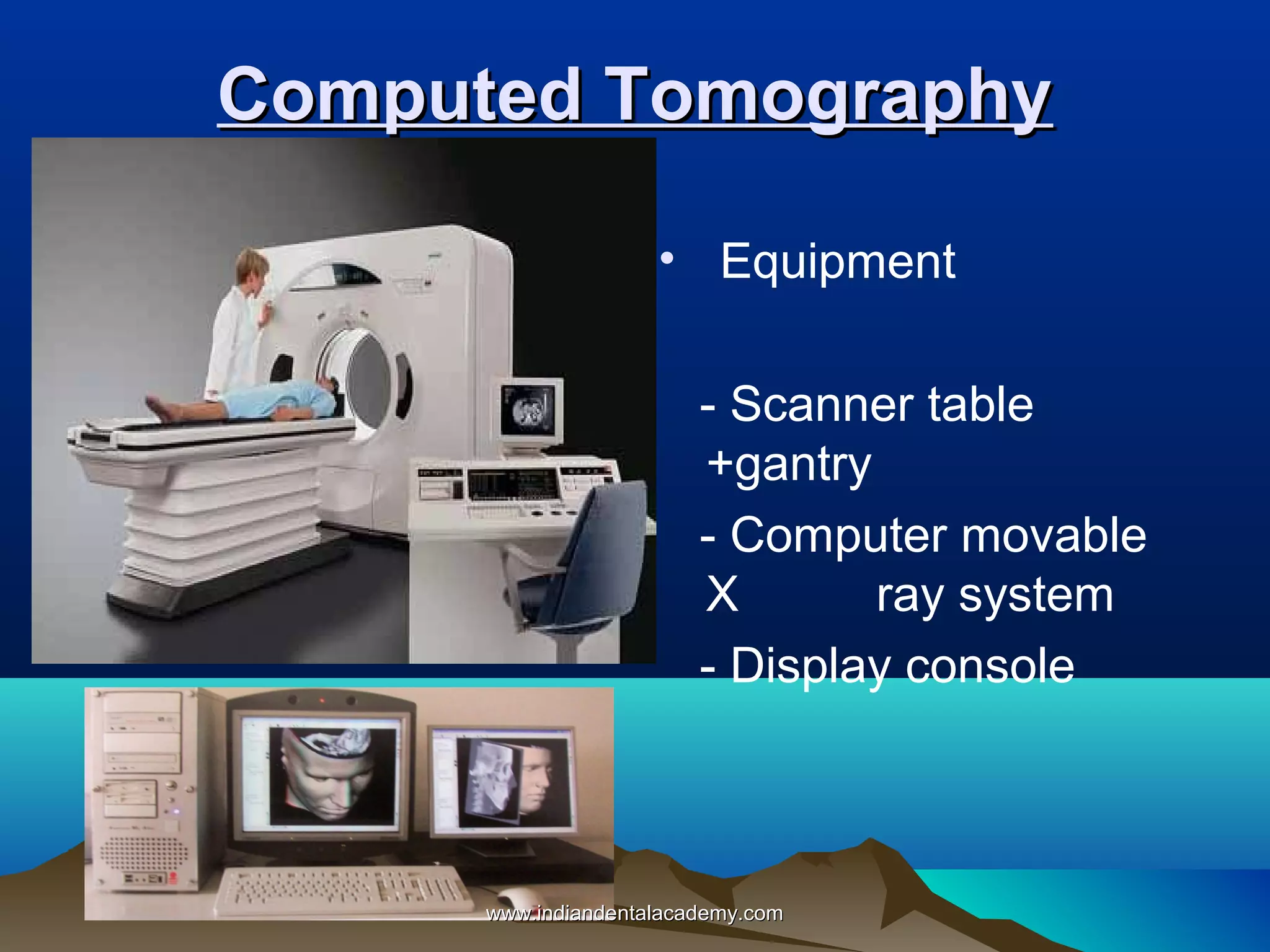 Computed Tomography
• Equipment
- Scanner table
+gantry
- Computer movable
X
ray system
- Display console

www.indiandentalacademy.com

 