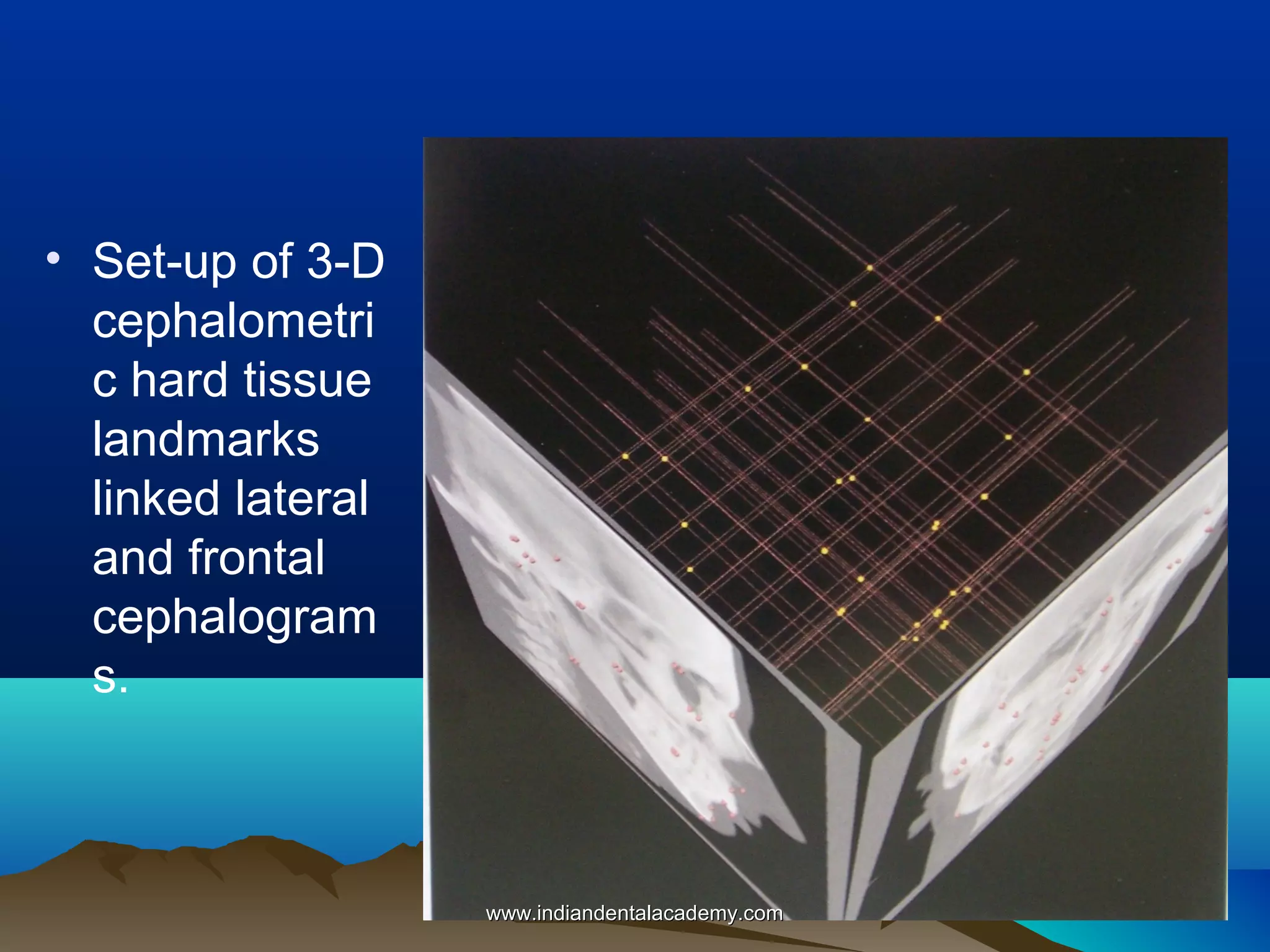 • Set-up of 3-D
cephalometri
c hard tissue
landmarks
linked lateral
and frontal
cephalogram
s.

www.indiandentalacademy.com

 