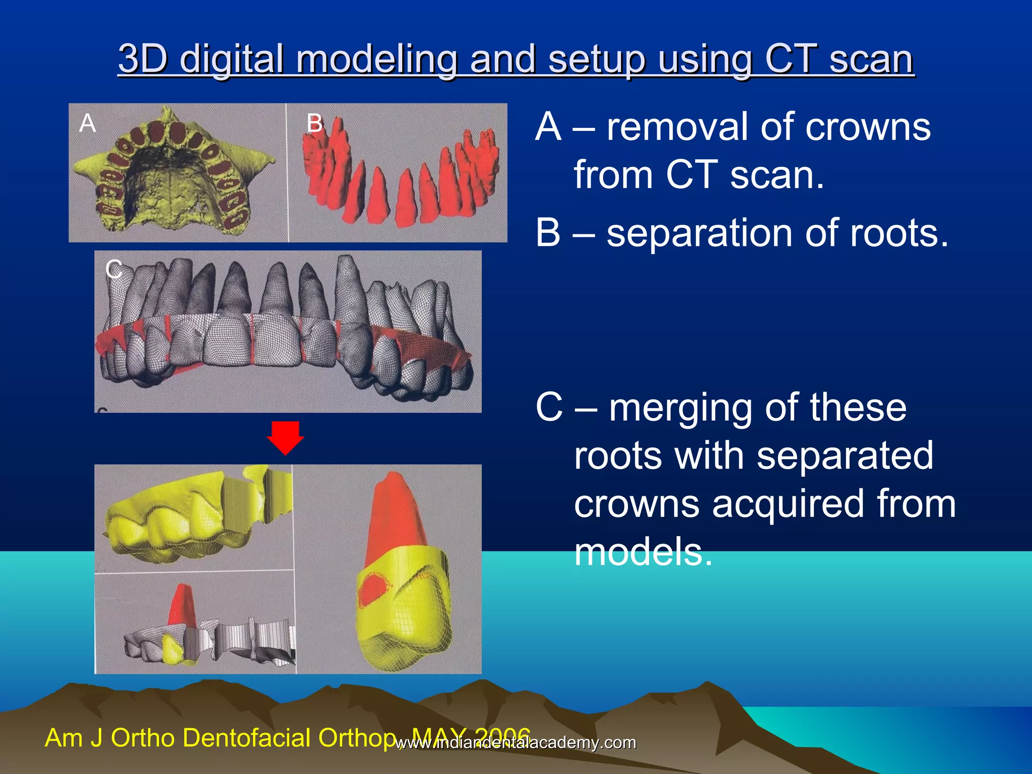 3D digital modeling and setup using CT scan
A

B

A – removal of crowns
from CT scan.
B – separation of roots.

C

C – merging of these
roots with separated
crowns acquired from
models.

Am J Ortho Dentofacial Orthop, MAY 2006
www.indiandentalacademy.com

 