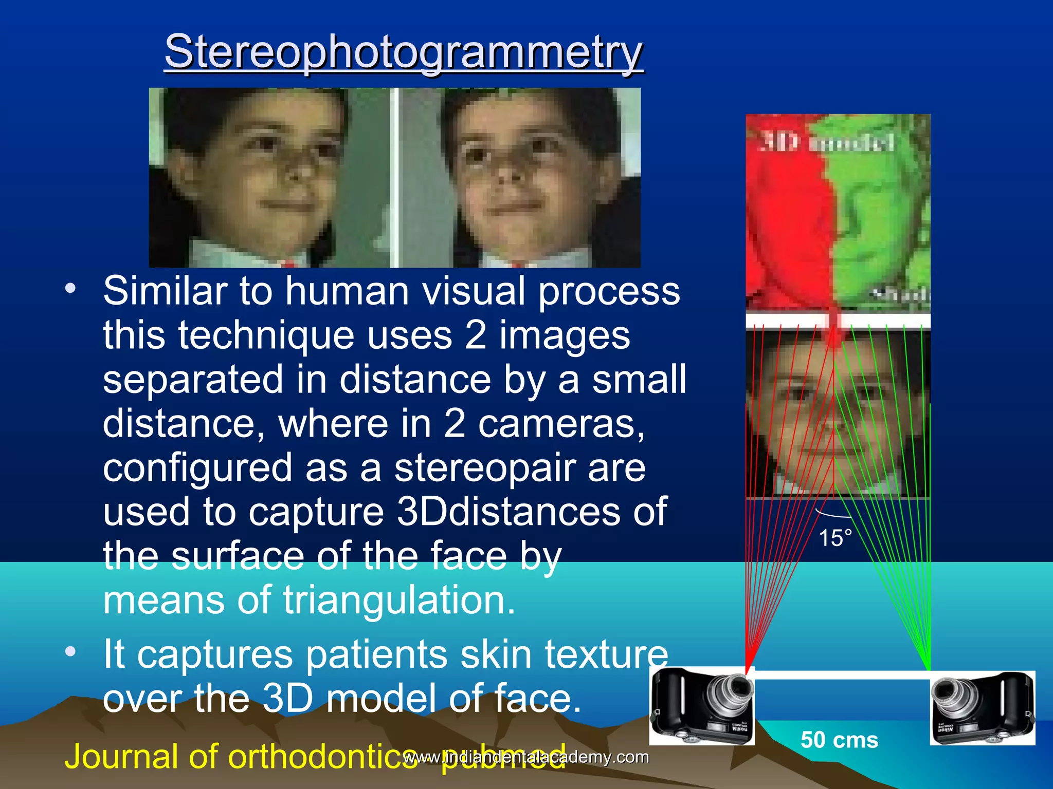 Stereophotogrammetry

• Similar to human visual process
this technique uses 2 images
separated in distance by a small
distance, where in 2 cameras,
configured as a stereopair are
used to capture 3Ddistances of
the surface of the face by
means of triangulation.
• It captures patients skin texture
over the 3D model of face.
Journal of orthodontics- pubmed

www.indiandentalacademy.com

15°

50 cms

 