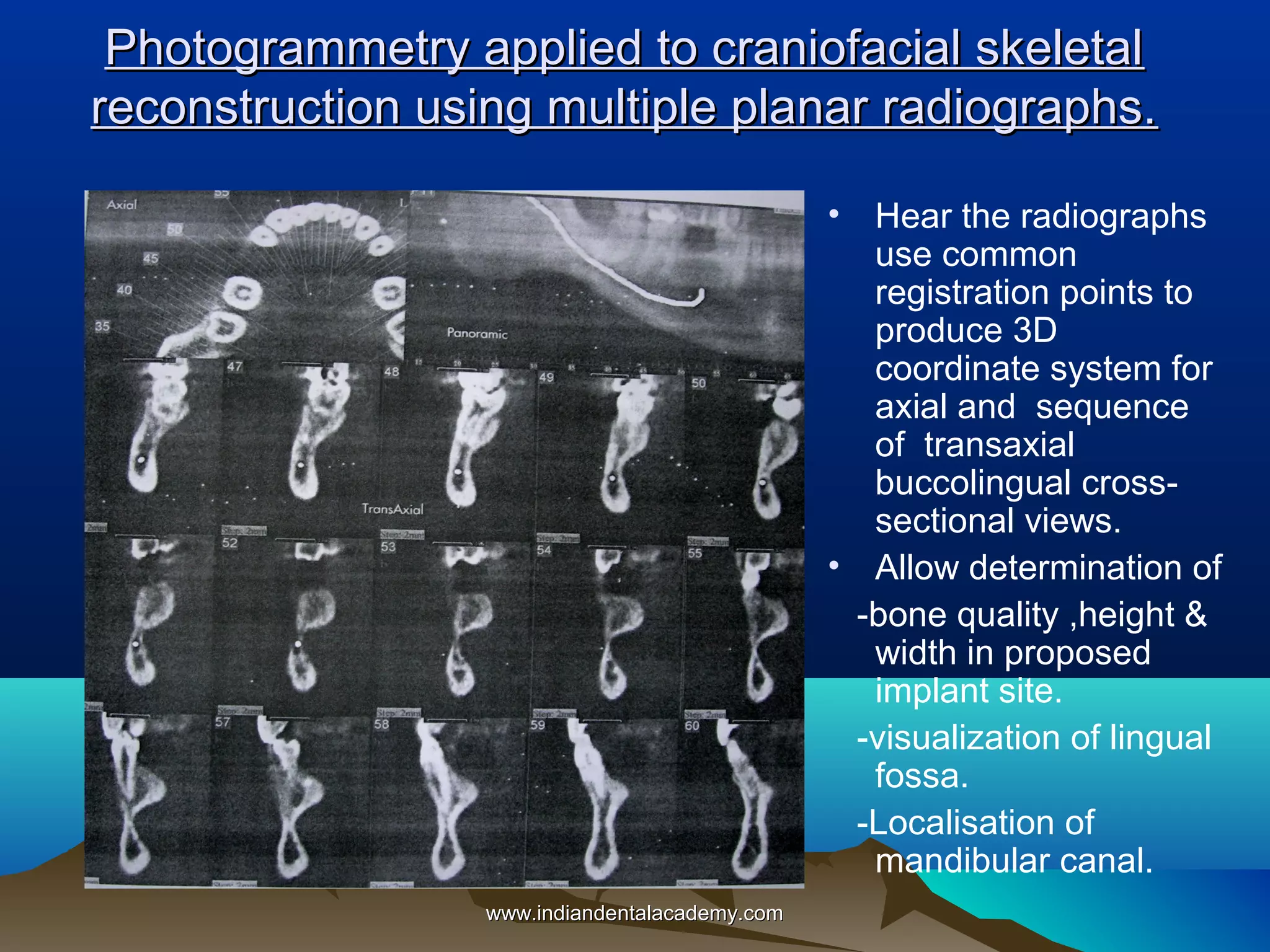 Photogrammetry applied to craniofacial skeletal
reconstruction using multiple planar radiographs.
• Hear the radiographs
use common
registration points to
produce 3D
coordinate system for
axial and sequence
of transaxial
buccolingual crosssectional views.
• Allow determination of
-bone quality ,height &
width in proposed
implant site.
-visualization of lingual
fossa.
-Localisation of
mandibular canal.
www.indiandentalacademy.com

 
