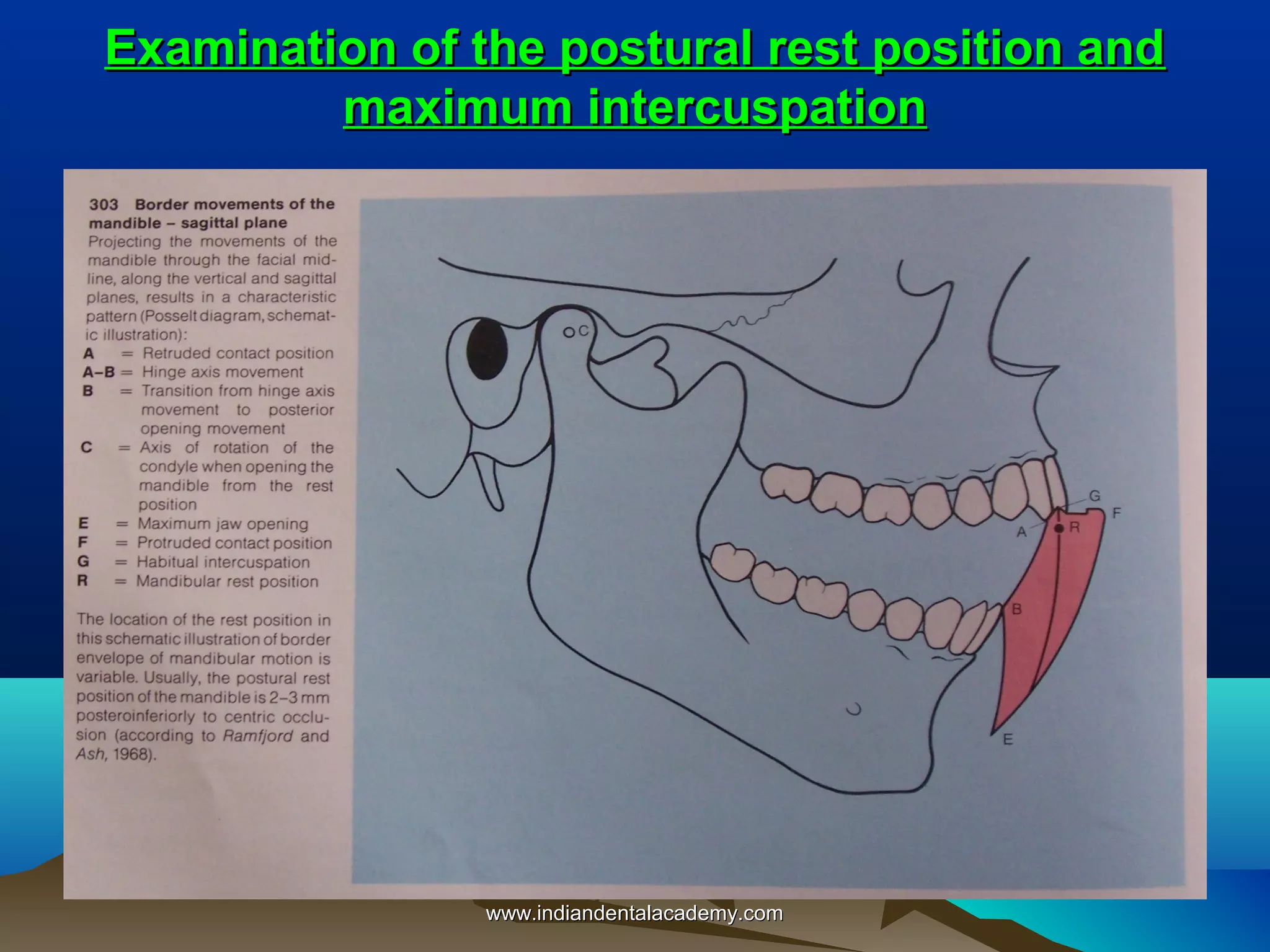 Examination of the postural rest position and
maximum intercuspation

www.indiandentalacademy.com

 