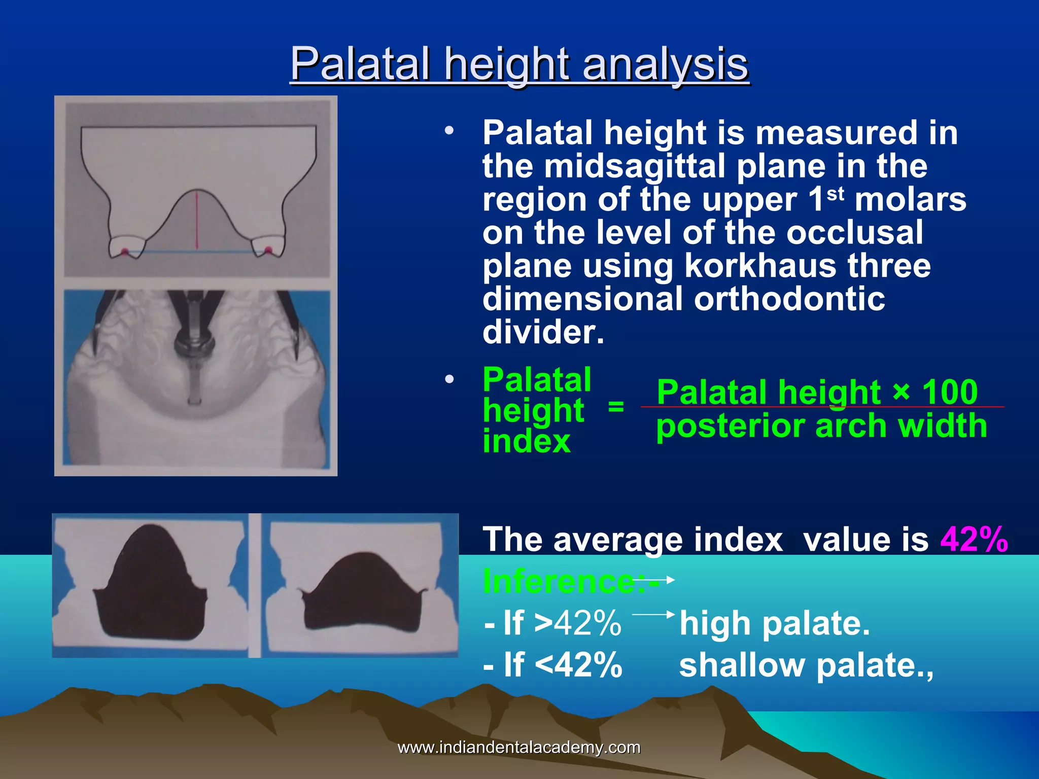 Palatal height analysis
• Palatal height is measured in
the midsagittal plane in the
region of the upper 1st molars
on the level of the occlusal
plane using korkhaus three
dimensional orthodontic
divider.
• Palatal
= Palatal height × 100
height
posterior arch width
index
• The average index value is 42%
• Inference:- If >42%
high palate.
- If <42%
shallow palate.,
www.indiandentalacademy.com

 