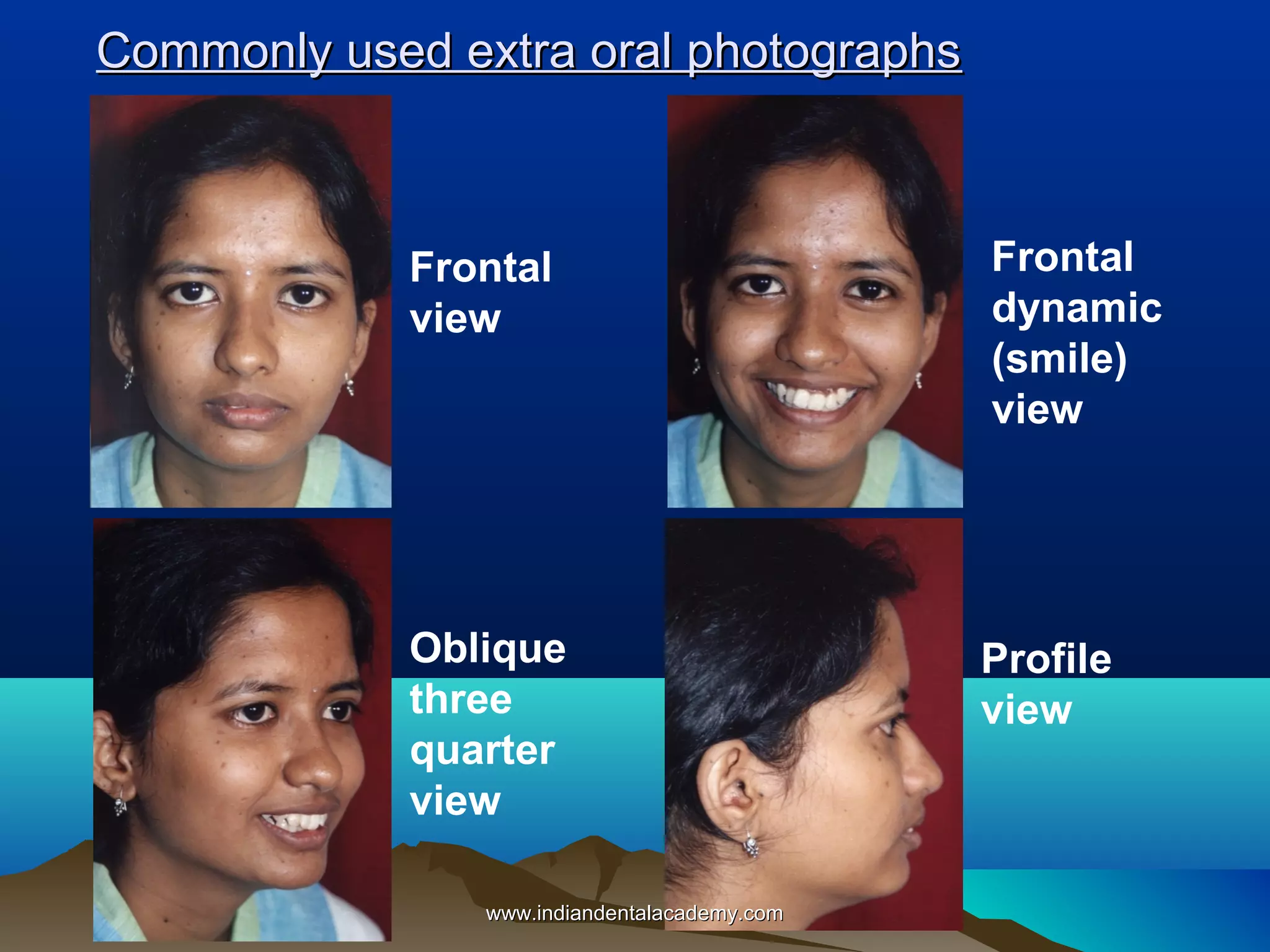 Commonly used extra oral photographs

Frontal
view

Frontal
dynamic
(smile)
view

Oblique
three
quarter
view

Profile
view

www.indiandentalacademy.com

 
