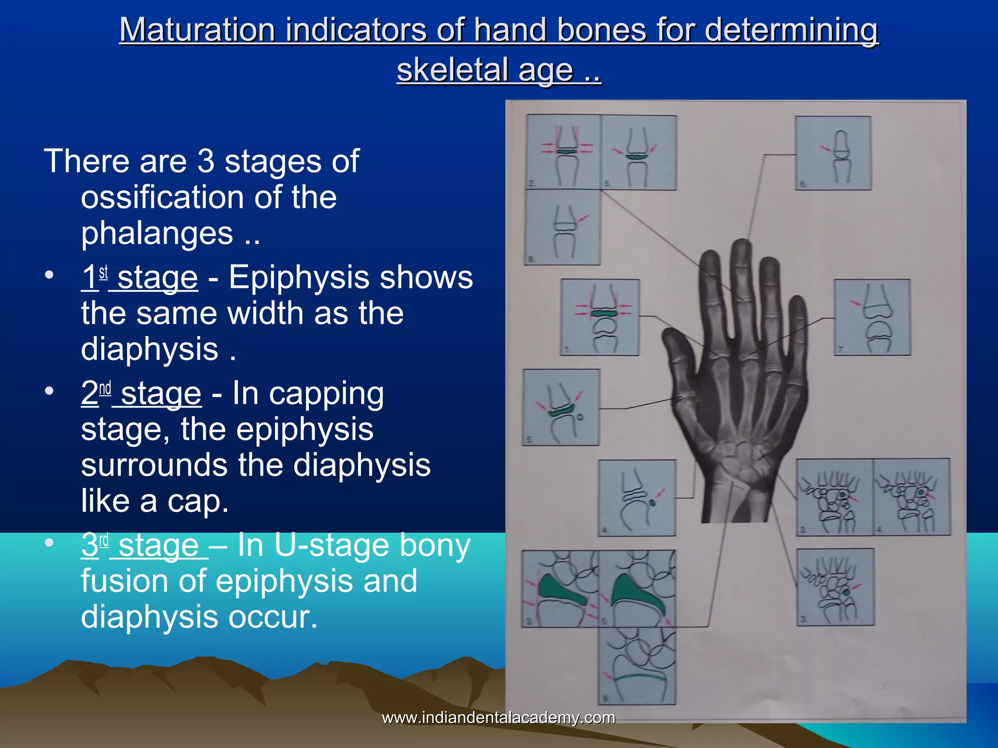 Maturation indicators of hand bones for determining
skeletal age ..
There are 3 stages of
ossification of the
phalanges ..
• 1st stage - Epiphysis shows
the same width as the
diaphysis .
• 2nd stage - In capping
stage, the epiphysis
surrounds the diaphysis
like a cap.
• 3rd stage – In U-stage bony
fusion of epiphysis and
diaphysis occur.
www.indiandentalacademy.com

 