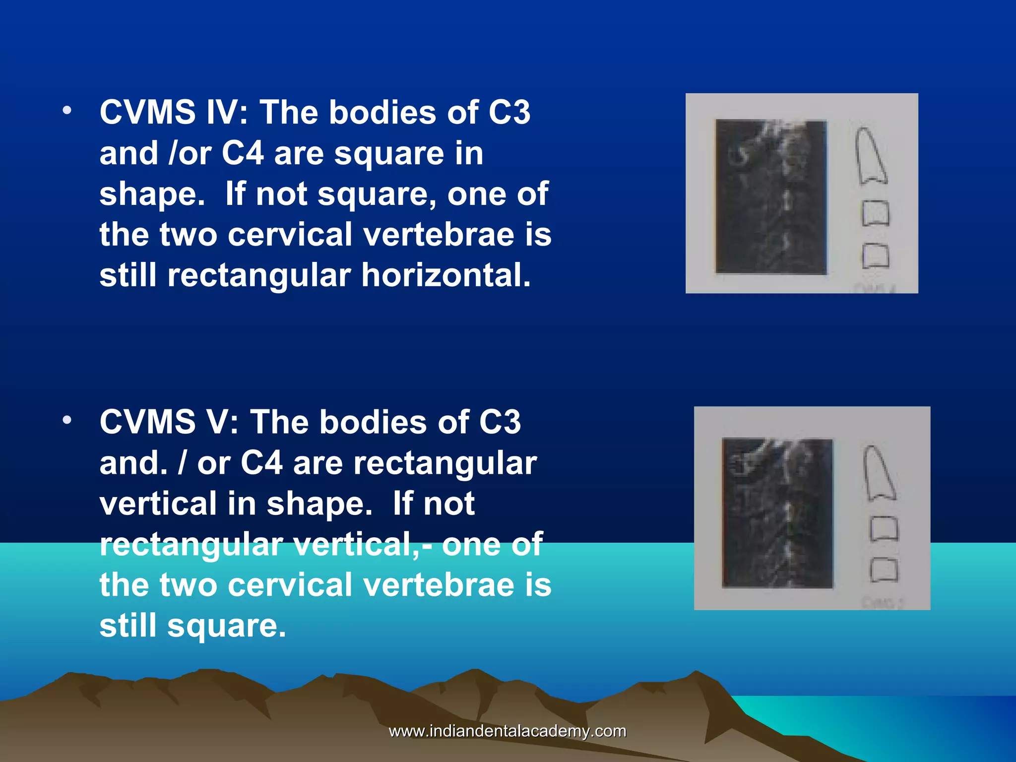 • CVMS IV: The bodies of C3
and /or C4 are square in
shape. If not square, one of
the two cervical vertebrae is
still rectangular horizontal.

• CVMS V: The bodies of C3
and. / or C4 are rectangular
vertical in shape. If not
rectangular vertical,- one of
the two cervical vertebrae is
still square.
www.indiandentalacademy.com

 