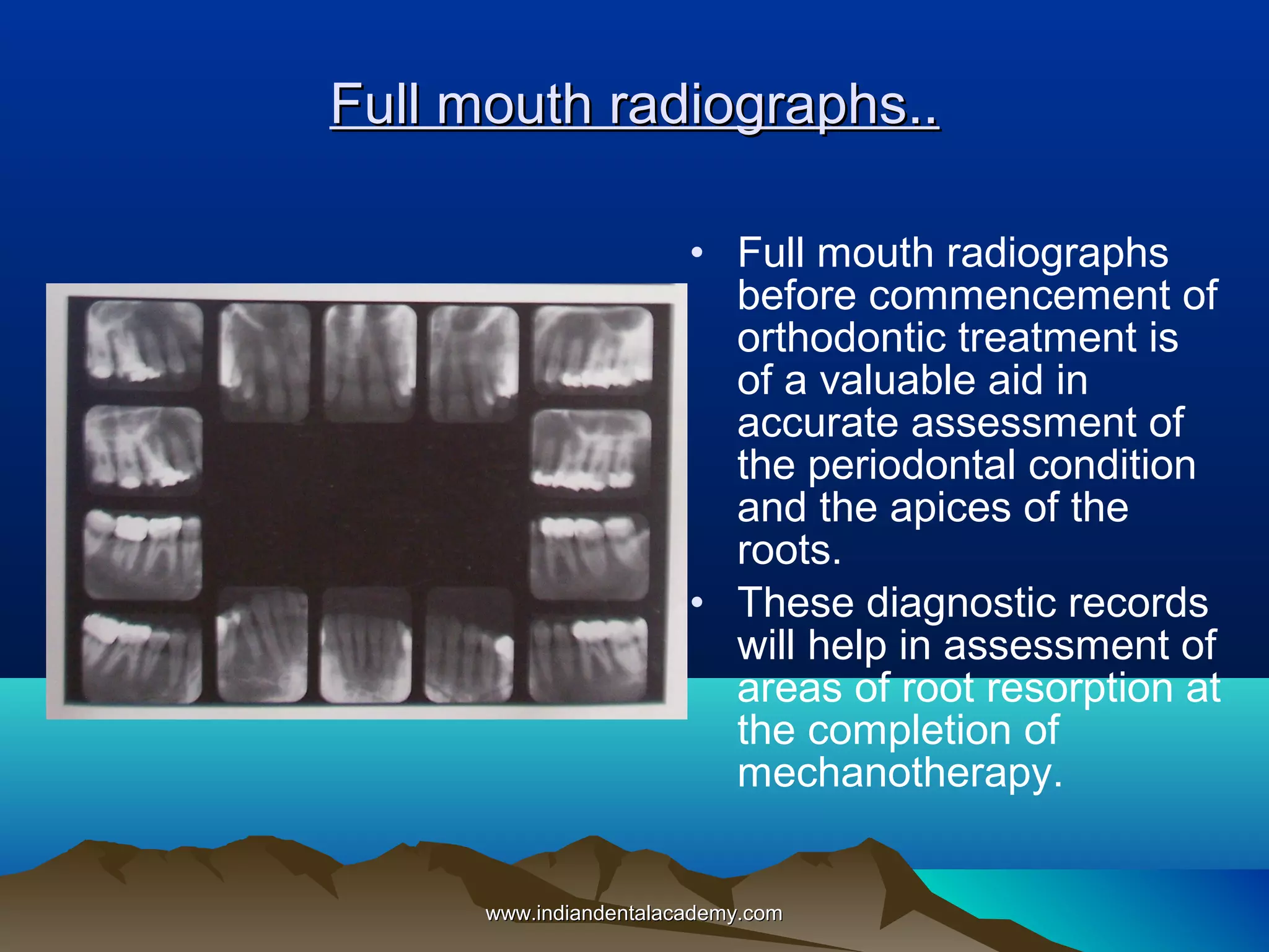 Full mouth radiographs..
• Full mouth radiographs
before commencement of
orthodontic treatment is
of a valuable aid in
accurate assessment of
the periodontal condition
and the apices of the
roots.
• These diagnostic records
will help in assessment of
areas of root resorption at
the completion of
mechanotherapy.
www.indiandentalacademy.com

 